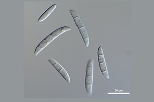 Fusarium sp. 분생포자 사진